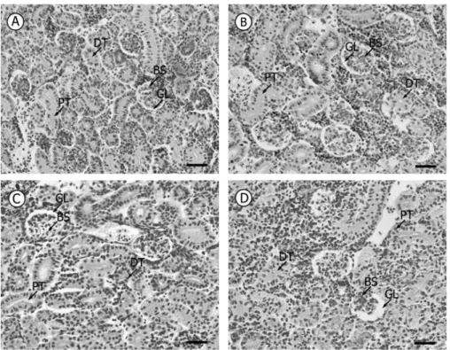 Fig.  6.  Micrographs  of  C.  auratus  kidney  during  20  days  exposed  to  Cd  0.3  mg/l  in  water