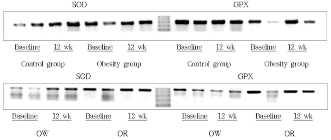 Fig.  1.  Express  of  SOD  and  GPX  mRNA.