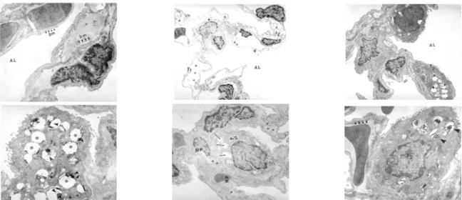 Fig.  1.  Electron  microscopic  finding  of  the  lung  of  experimental  rats.  In  normal  lung  of  rat,  basement  membrane  (BM)  was  well  preserved  and  alveolar  lumen  was  intact  (original  mag