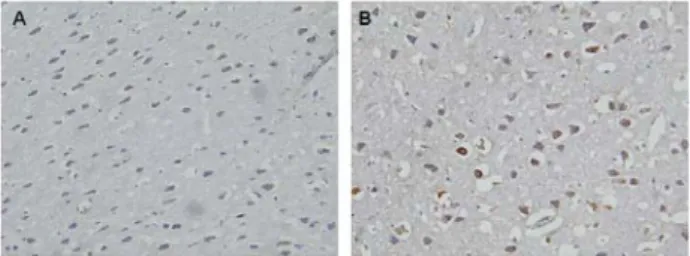 Fig.  3.  Immunohistochemical  staining  showing  the  expression  of  ASIC3.  Compared  to  sterile  saline  treatment  (B),  OPC  treatment  (A)  decreased  the  expression  of  ASIC3  in  brain  M1  and  M2  area  when  300  mg/kg  was  administered   i