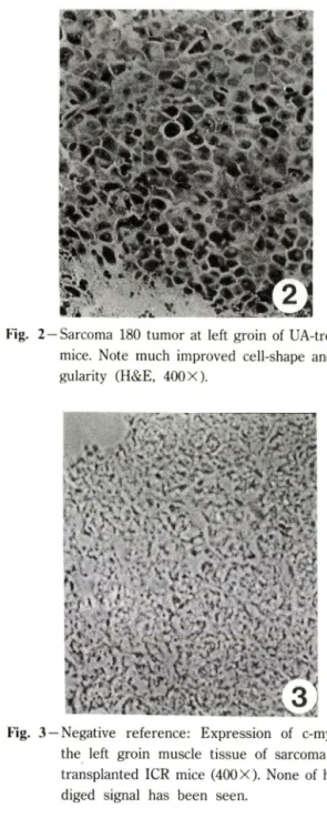 Fig.  1 — Sarcoma  180  tumor  at  left  groin  of  untreated  mice.  Note  dead  cell  mass(D),  necrotizing  re-  gion(N),  and  tumor  cell  mass(T)  (H&amp;E,  400 X)