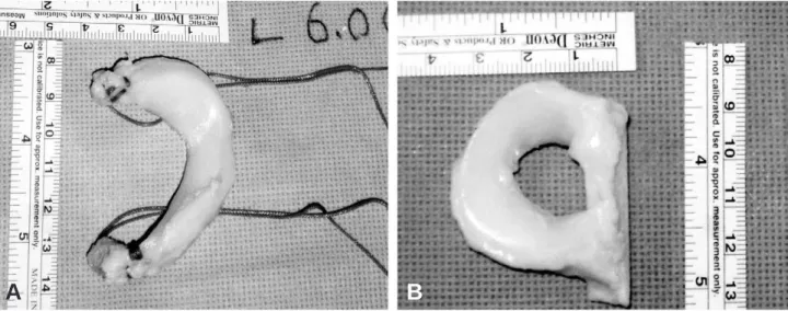 Fig. 1. Graft preparation