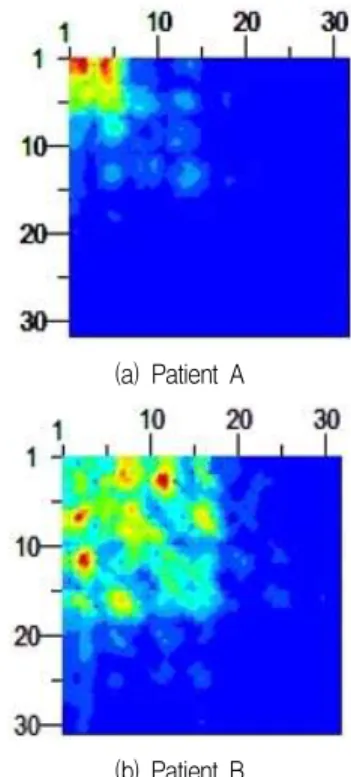 Fig. 8. Raw EEG Data of Patient B