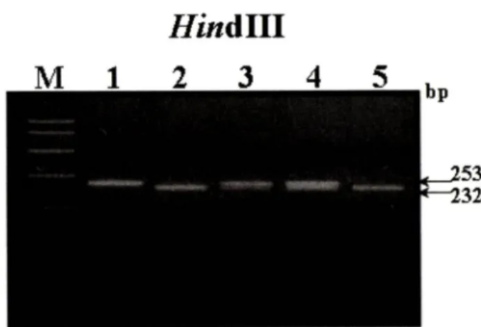 Fig.  1 - Electrophoretic patterns of the C298T polymorphism m the  osteocalcin gene. Lane M, molecular size marker：  lane  1,  CC  genotype：   lane  2—5,  TT  genotypes;  lane  3—4,  CT  genotypes