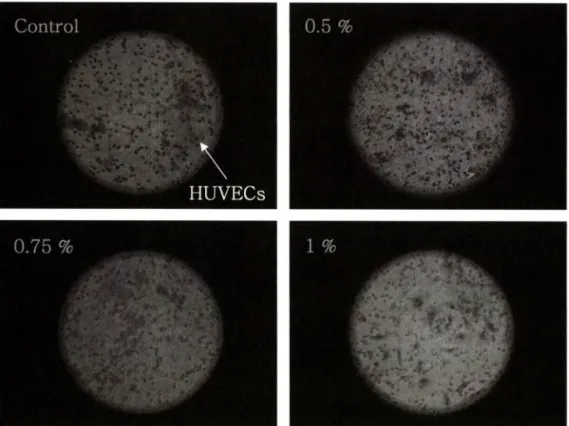 Fig.  4 - Inhibitory effect of water extract from  Selaginella involvens   Spring (SW) on HUVEC invasion assay