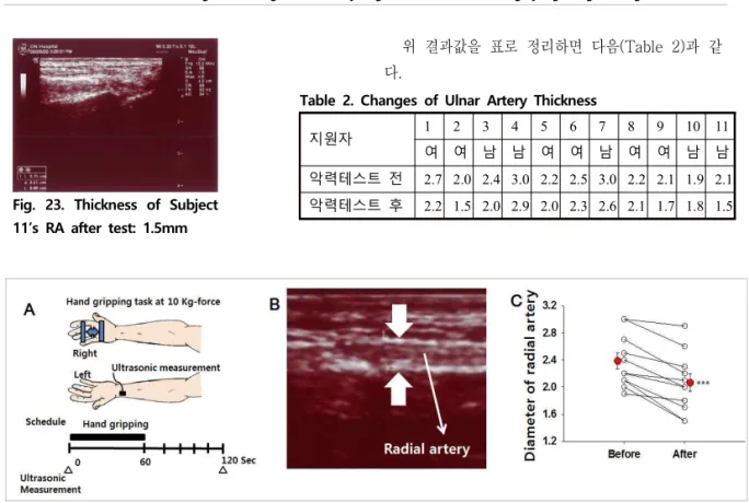Fig.  24.  Changes  of  Ulnar  Artery  Thickness  after  Hand-grip  TestFig.  23.  Thickness  of  Subject 