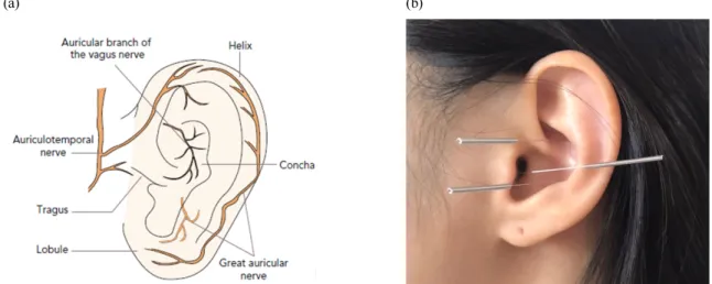 Fig.  2.  Points  of  acupuncture  treatment.  (a)  Field  of  auricular  branch  of  vagus  nerve  (Adapted  from  Jiang    et  al.) 23) ,  (b)  Points of  acupuncture  treatment.