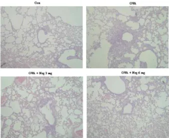 Fig. 1. Effect of Naringin on total and differential cellular com- com-ponents of BAL fluids of OVA-sensitized and  OVA-chal-lenged mice