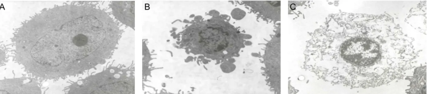 Fig. 7. Effects of photodynamic therapy. Left panels show dis- dis-tinct living, necrotic, apoptotic SNU1041 cells by  fluo-resence microscopy (Original magnification: X200)