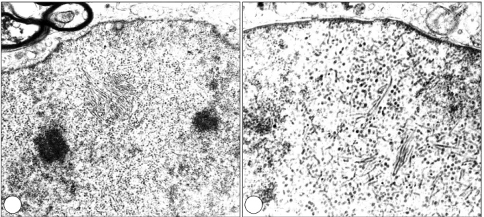 Fig. 4. Electron microscopy discloses intranuclear, elongated and round virions distributed randomly and in crystalline arrays  (A：×33,580, B：×76,000)
