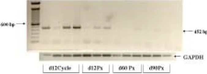 Fig.  1.  The  expression  pattern  of  ER-α  in  the  uterus  during  the  early-  (d  12),  mid-  (d  60)  and  late-  (d  90)  pregnancy  and  in  the  cycling  (d  12)  in  pig