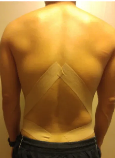 Fig 1. Pelvic taping