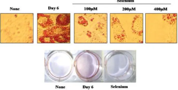Fig. 1. The effects of selenium on 3T3-L1 adipocyte differentia- differentia-tion. Postconfluent 3T3-L1 cells were differentiated with hormonal mixtures in the absence or presence of selenium (100-400 µM ) for 6 days
