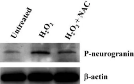 Fig 4. W estern blot analysis for the treated to H 2 O 2 and N-ace- N-ace-tyl-L-cysteine (NAC) from cultured neurosphrers in the EBD KO mice brain