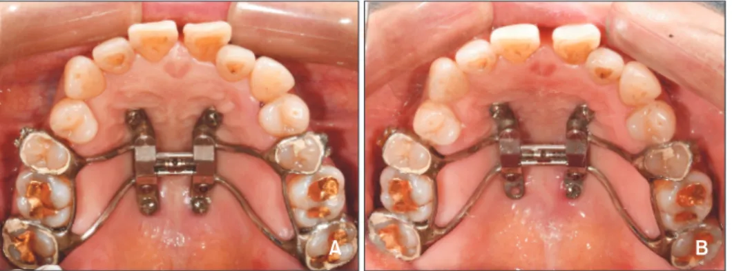 Figure 3. Treatment progress 