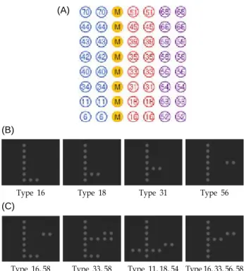 Fig.  5.  Finding  of  invasive  cervical  carcinoma.  Nuclei  show  a  marked  variation  of  size/shape,  numerous  dense,   opa-que  forms  chromatin,  which  is  coarsely  granular  and   ir-regularly  distributed