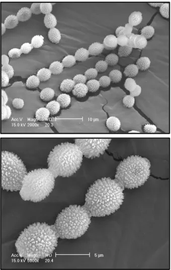 Fig.  2.  Ascospores  of  Aspergillus  flavus  attached  on  the  surface  of  test  corn  (SEM  Images;  ×2,000,  ×5,000).