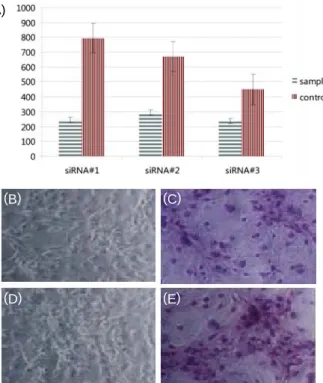 Fig.  1.  Effect  of  aromatase  siRNA  transfection  on  3T3-L1  differentiation.  3T3-L1  preadipocyte  were  transfected  by  siRNA  of  aromatase  and  the  differentiated