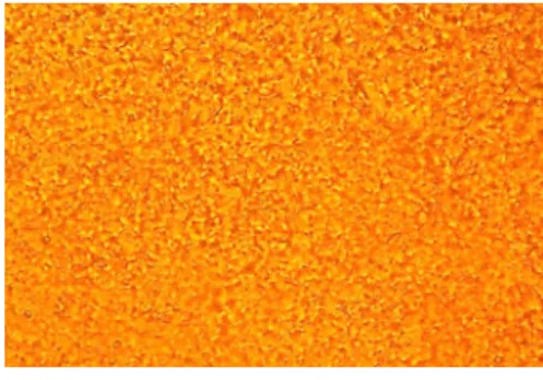 Figure 7. Optical micrograph of P-Ch taken 168 ℃  (×50).