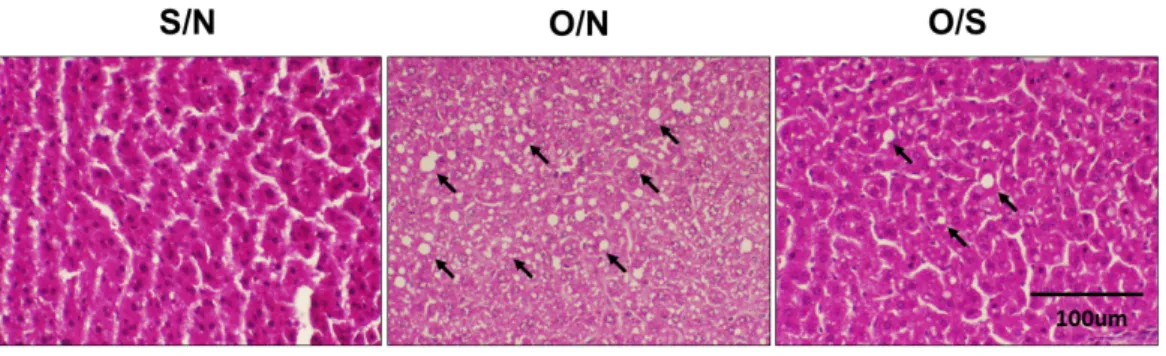 Fig.  2.  Effects  of  exercise  on  hepatic  lipid  accumulation.