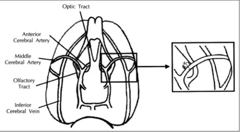 Fig. 3. MCA occlusion at proximal olfactory bulb. 