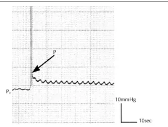 Fig. 1. Measurement of pressure-volume index. PVI was cal- cal-culated according to the formula  {PVI＝V-Vo/(logP-logPo), (P>Po)} after intraventricular bolus injection of 0.025-0.03ml heparinized normal saline(Heparin 10,000 unit in 1000ml normal saline