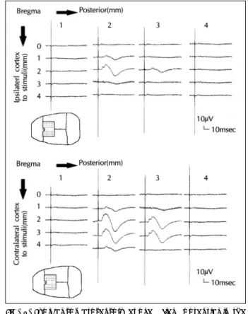 Fig. 5. Change of intracranial pressure-volume index accor- accor-ding to the severity of induced hydrocephalus(r＝ 