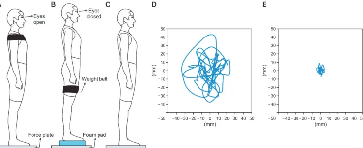Figure 2.  Sample schematics of quiet standing tasks with (A) eyes open, COM raised, and stable floor condition, (B) eyes closed, COM lowered, and un- un-stable floor condition, and (C) eyes open, COM not changed, and un-stable floor condition, along with 