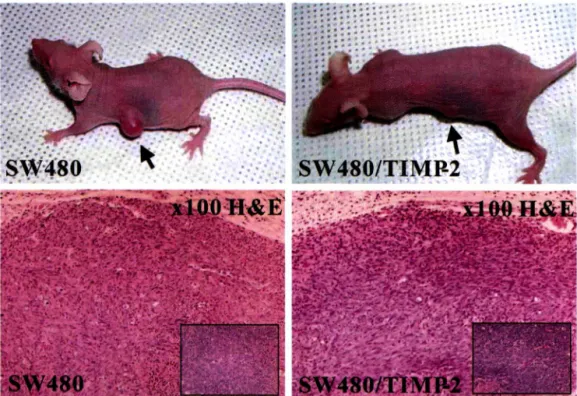 Fig.  7 - Tumorigenecity formation  of SW480&amp;SW480/TIMP-2  cells  in  nude  mice.  Note well-demarcation  of tumor  mass  and necrosis  and  angiogenesis in inset, but there is no difference between SW480 and SW480/TIMP-2 in terms of cellularity, diffe