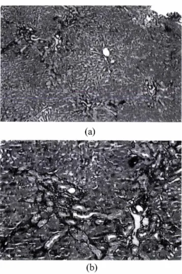 Fig. 4 - Masson's trichrome stained liver tissue of LH treated rat. (a)  The liver tissue of in 4 weeks LH treated rat after BDL/S  operation  (x40),  (b)  The  liver  tissue  of  in  4  weeks  LH  treated  rat  after  BDL/S  operation  (xlOO)