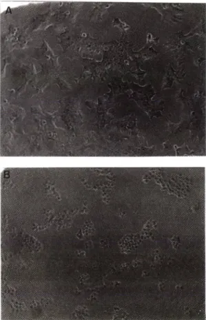 Fig.  1 — Morphological  appearance  of  ICSA-reactive  RINmSF  cells  by  inverted  microscope  (magnification x 40)