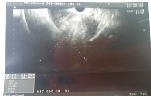 Fig. 1. April 14, 2014 Ultrasound Image