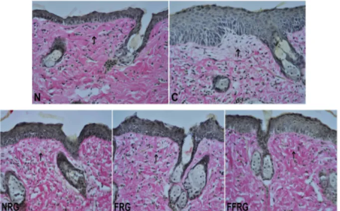 Fig. 5. Histological changes in the skin of SKH-1 mice exposed to 4 weeks of UVB irradiated experimental groups(C, NRG, FRG, FFRG) and non-irradiated normal group(N)(Masson , s trichrome stain, x200)