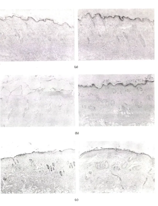 Fig.  2 — Vertical  section views of normal  (a),  burned  (b)  and  stripped  (c)  skins  following single  (left column)  and  multiple  (right column)  dose studies
