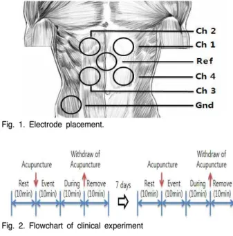 Fig. 1. Electrode placement.