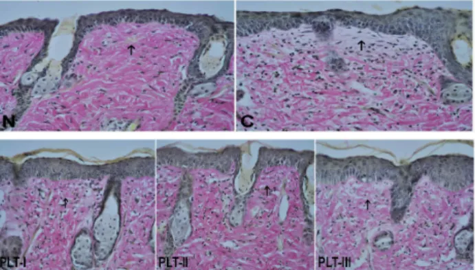 Fig. 3. Changes of epidermal thickness in the skin of SKH-1 mice exposed to 4 weeks of UVB irradiated experimental groups(C, PLT-I, PLT-Ⅱ, PLT-Ⅲ) and non-irradiated normal group(N)
