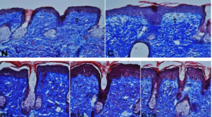 Fig. 5. Histological changes in the skin of SKH-1 mice exposed to 4 weeks of UVB irradiated experimental groups(C, PLT-I, PLT-Ⅱ, PLT-Ⅲ) and non-irradiated normal group(N)(Masson , s trichrome stain, ×200)