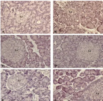 Fig. 5. Light micrographs of pancreatitis in each groups. Pancreas from a rat injected with caerulein alone shows extensive inflammation and vacuolization (B).