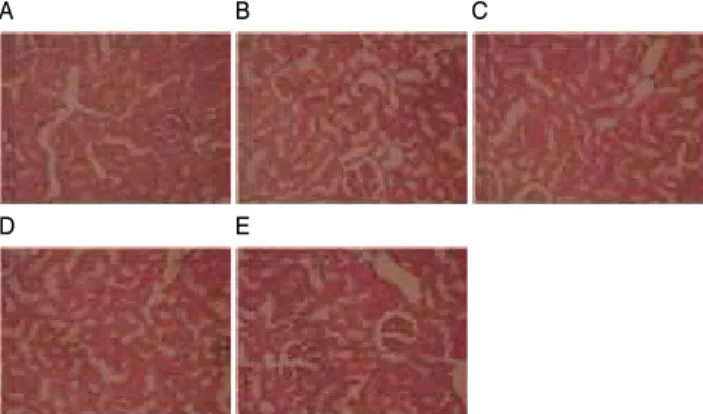 Fig. 2. Effect of Shiitake mushroom extract administration on the kidney tissue in hyperlipidemic rats (H&amp;E stain, × 200)