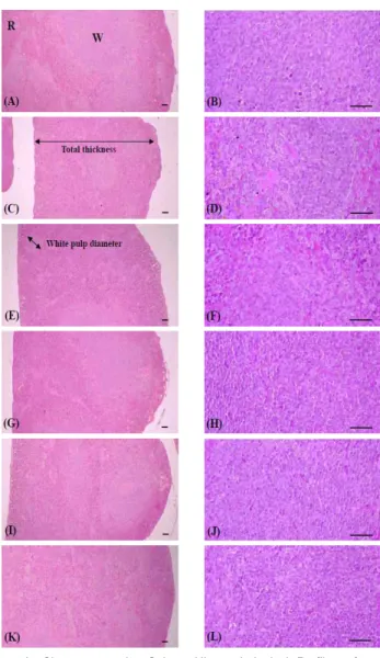 Fig. 10. Changes on the Spleen Histopathological Profiles after Insamyangyoung-tang Extracts Administrations Note that the atrophic changes related to the decrease of splenic white pulp lymphoid cells were detected in tumor‐bearing control as compared with