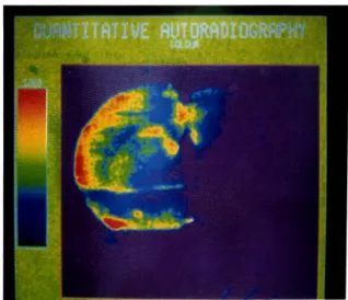 Fig. 4 — Autoradiograph  of  section  of rat  brain  10  min  after i.v.  administration of  탄 "TcrDTPA to rat (8  mCi)