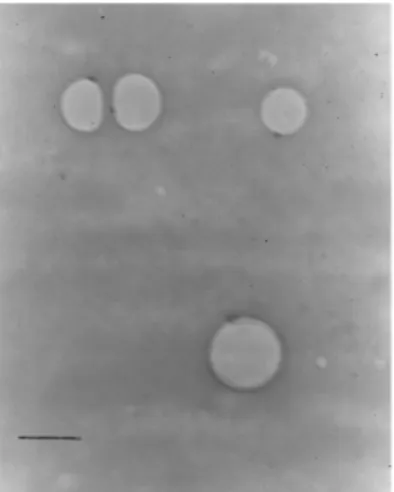 Figure 2. TEM images of ULVs obtained from octasubstituted cyclo- cyclo-phosphazene (bar represents 200 nm).