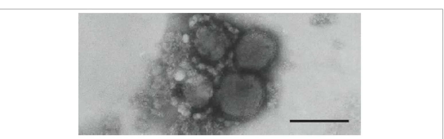 Figure 1. Crimean-Congo hemorrhagic fever virus The bar represents 100nm.