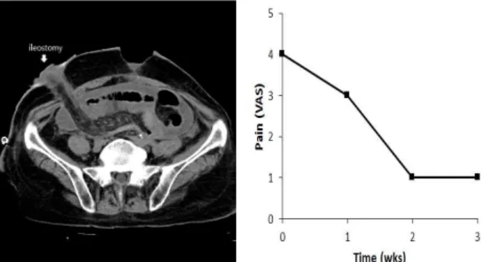 Fig. 1. Abdomen CT and Pain Graph of Patient 1.