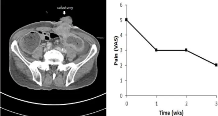 Fig. 6. Abdomen CT and Pain Graph of Patient 6.