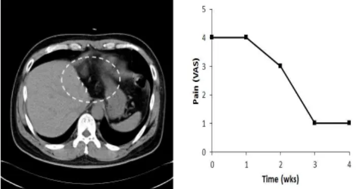 Fig. 7. Abdomen CT and Pain Graph of Patient 7.