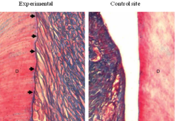 그림 7. Histological sections (Azan staining), 4 weeks post-trans- post-trans-plantation, of human periodontal ligament cell sheets to rats