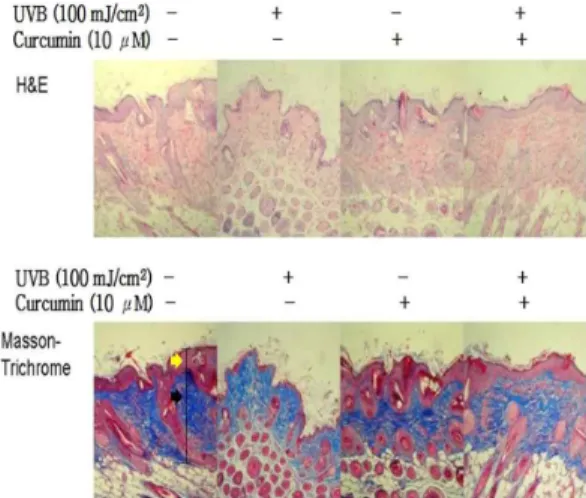 Fig. 5. Effect of solution containing curcumin on UVB-induced photodamaged tissue on hairless mice