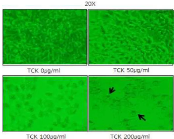 Fig. 1. Effect of TCK on cell morphology in MCF-7 cell. Cell density of MCF-7 cell decreased dose-dependently after TCK