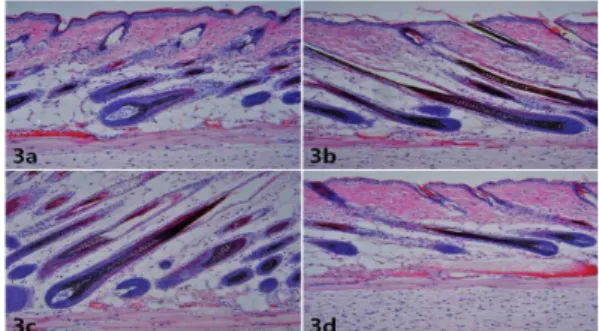 Fig. 2. Handscopic observation of skin 10 days after topical treatment of 70% ethanol as control (2a), plum-bloosom needle(2b), strong(2c) and weak moxibustion(2d)
